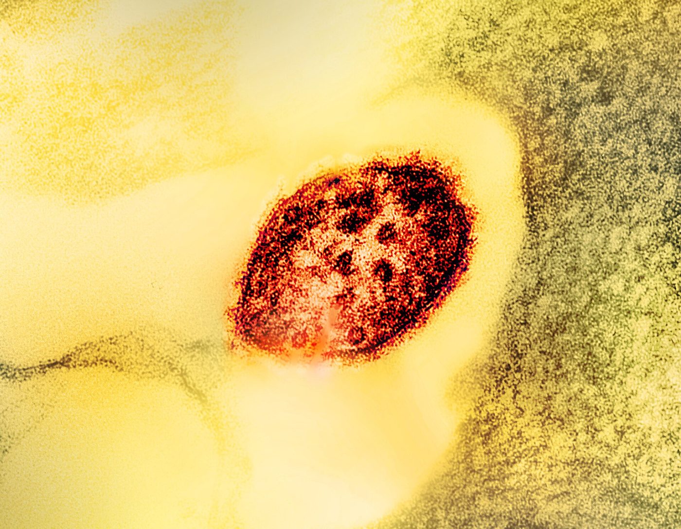 Colorized electron microscope image of a measles virus particle
