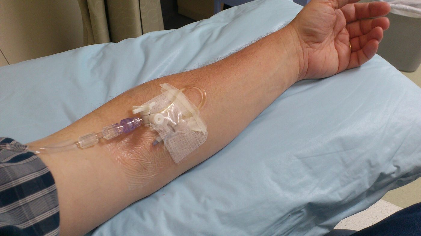 An intravenous immunoglobulin infusion being given to a patient