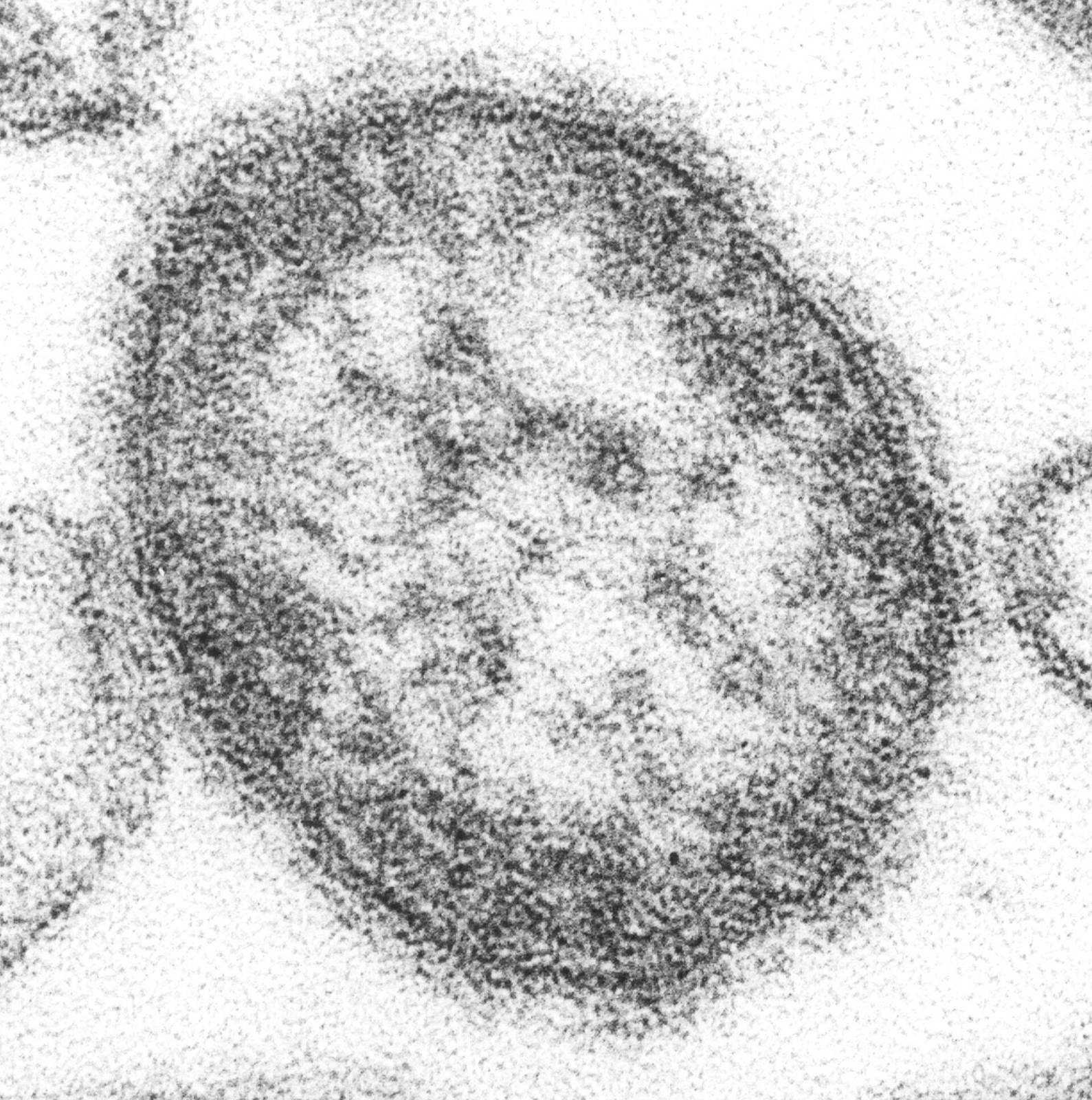 Electron micrograph of measles virus particles