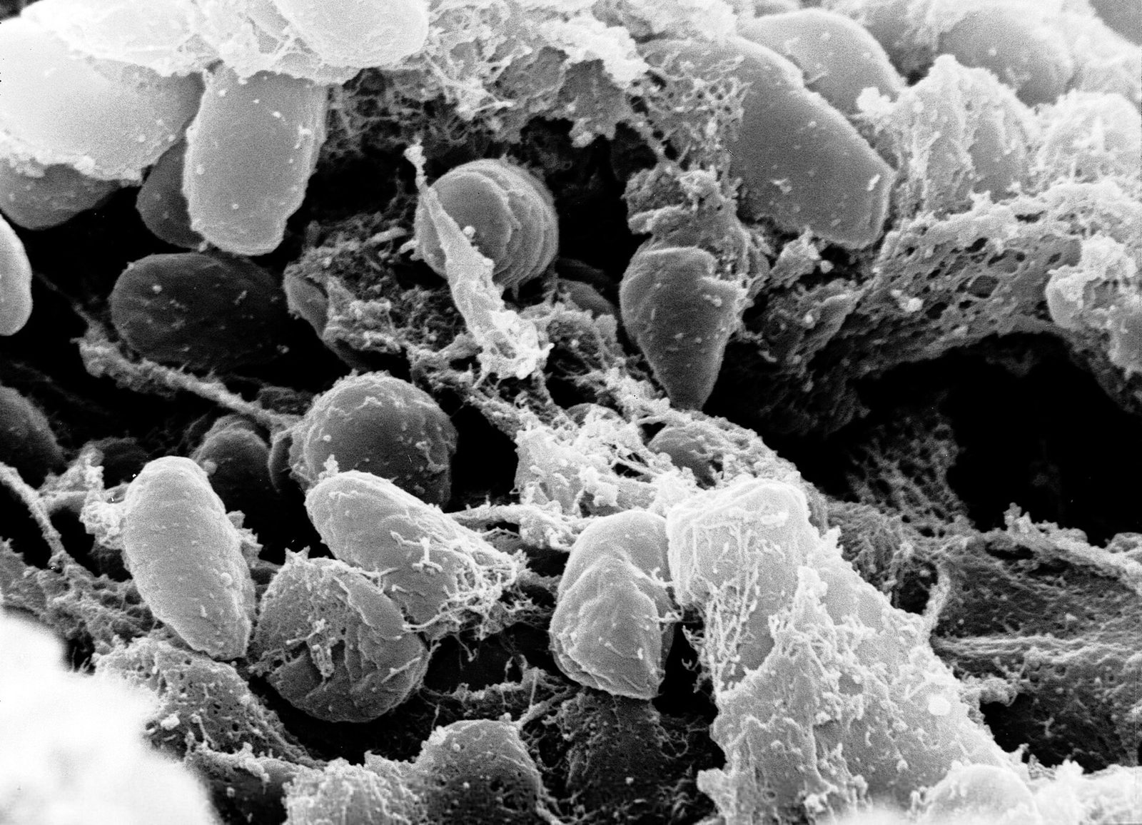 Microscope image of Yersinia pestis, the bacteria that cause plague