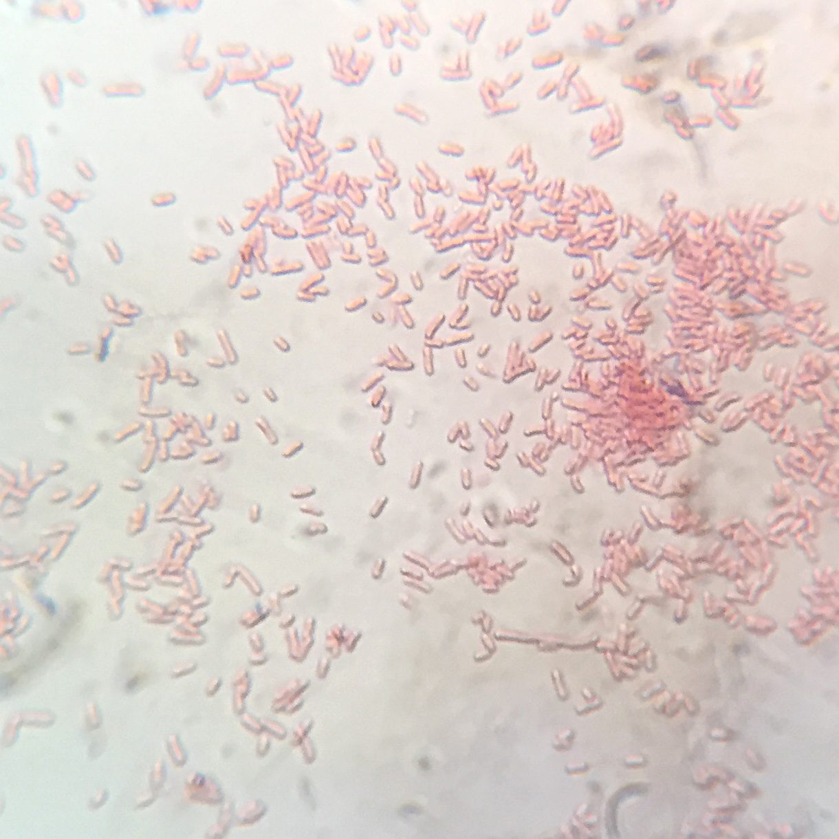 Shigella flexneri Gram Stain on Microscope Slide