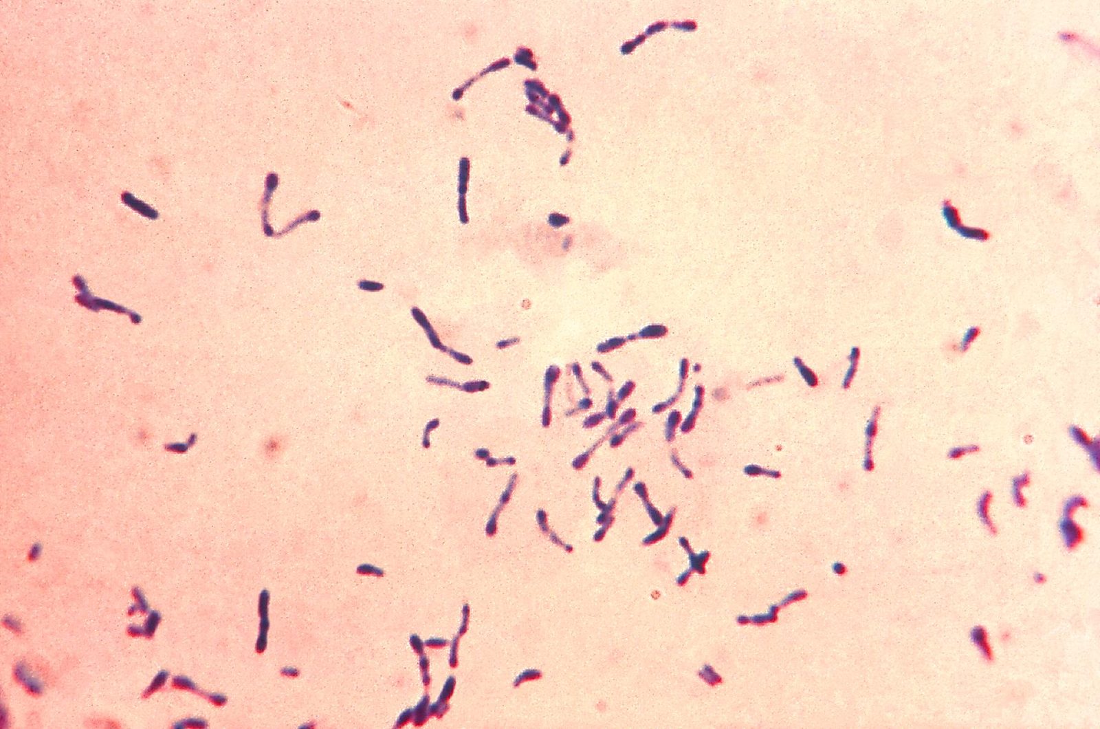 Microscope image of Corynebacterium diphtheriae, the bacteria that cause diphtheria