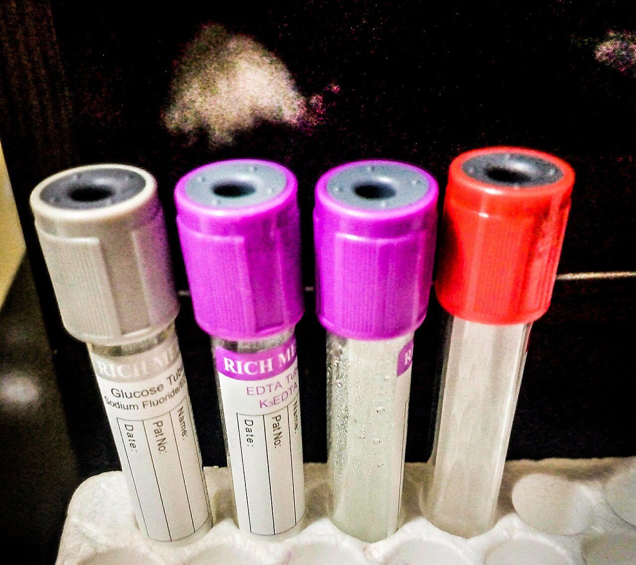 Rows of colored blood test tubes in a medical laboratory