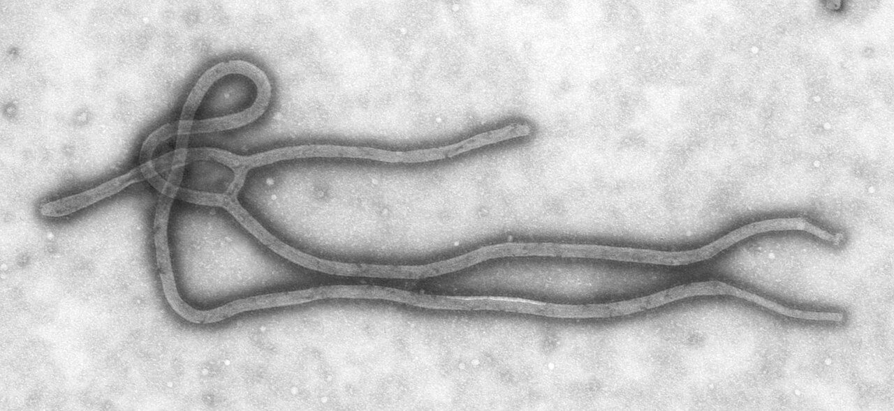 An Ebola virus particle seen under an electron microscope