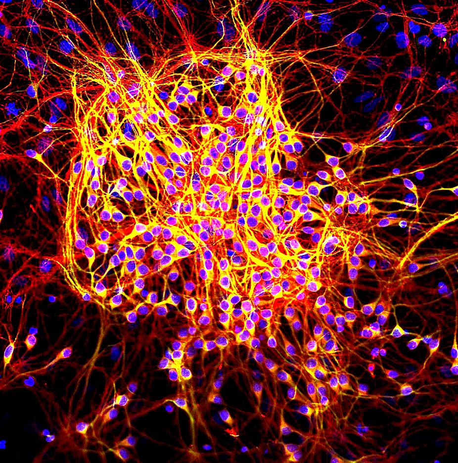 Microscope image of neurons stained red and yellow, with a dense web of branching fibers and blue-purple cell nuclei