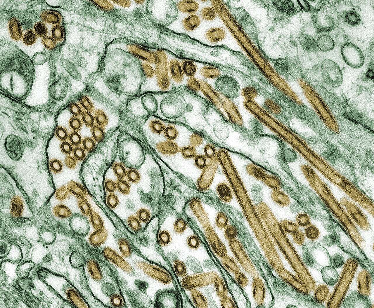 Colorized electron microscope image of gold-colored flu virus particles among green cells