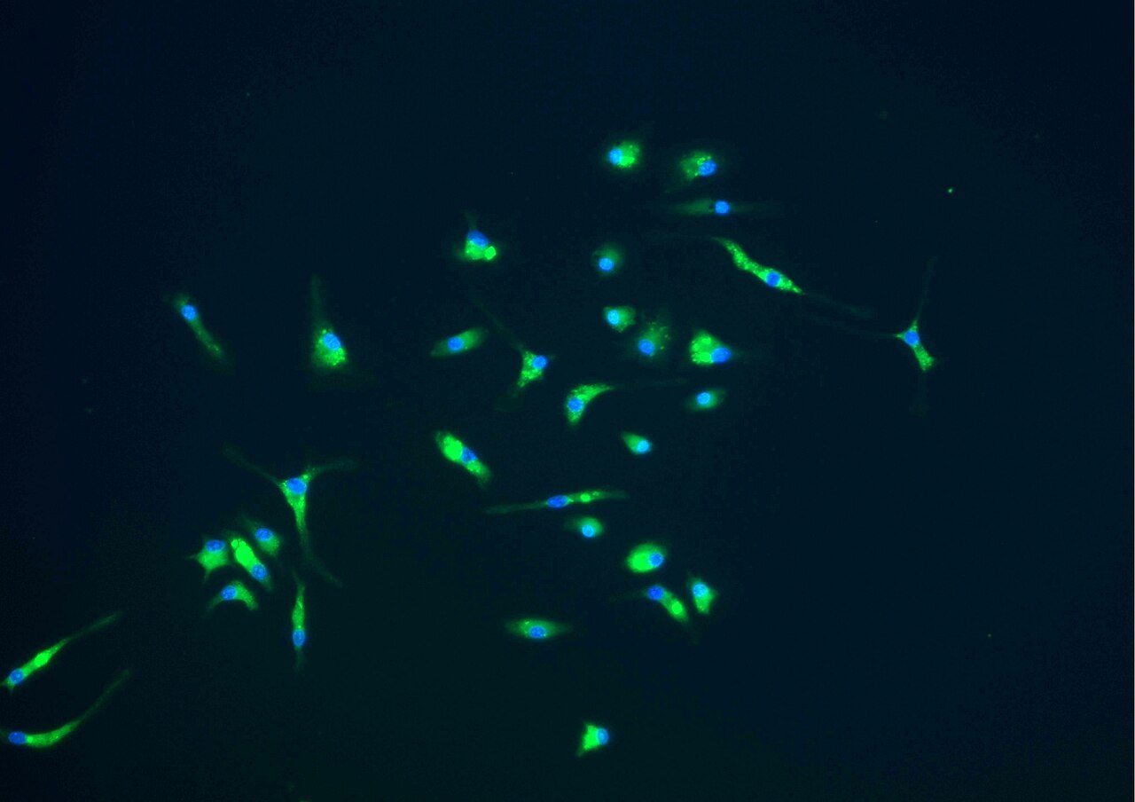 Scattered green-stained cells with blue centers and thin branches on a black background