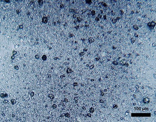Microscope view of many tiny round plastic beads, with a 100-micrometer scale bar in the corner