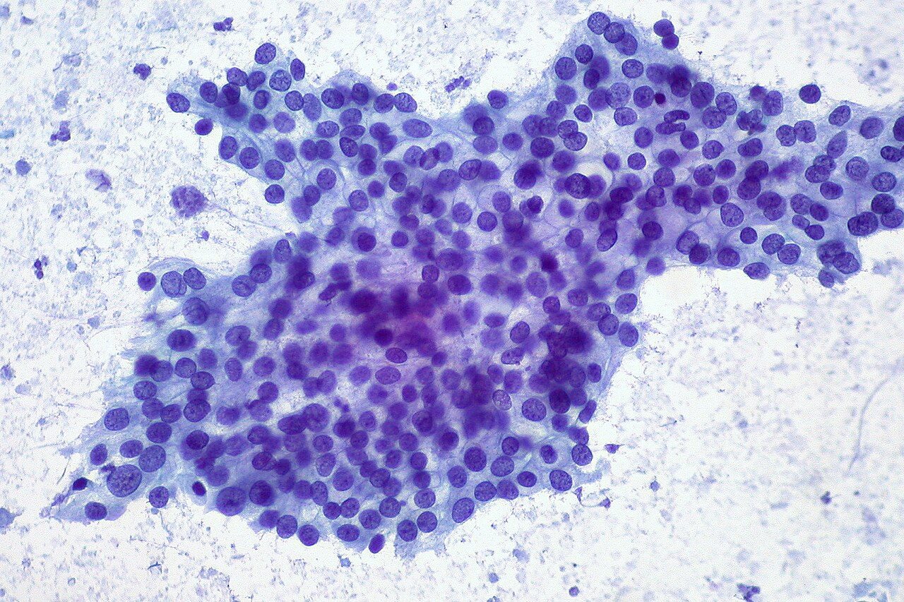 Microscope image of a cluster of purple-stained cells on a pale background