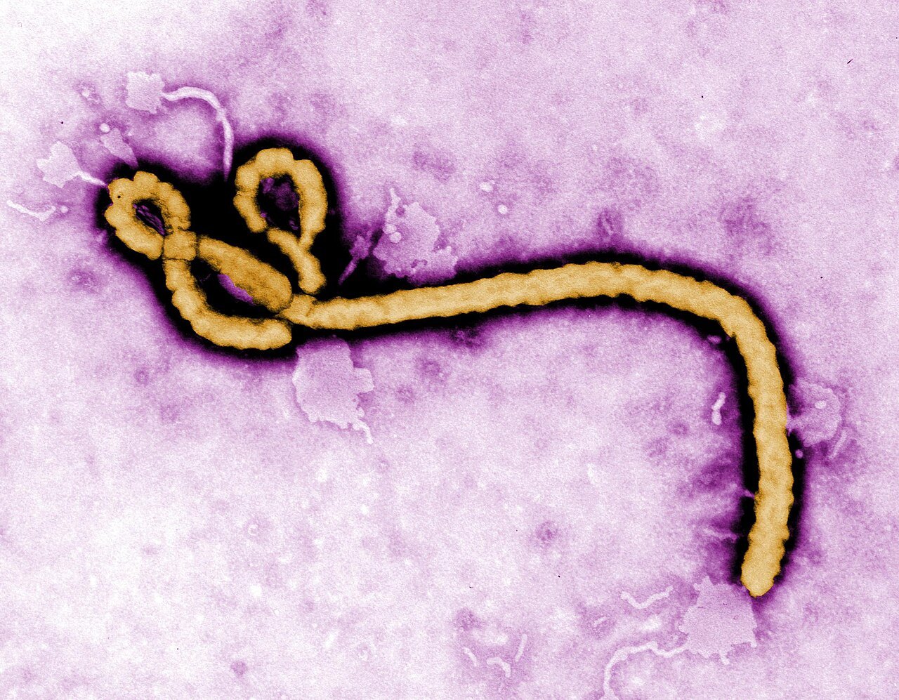 A colorized microscope image of a single curled, thread-like Ebola virus particle