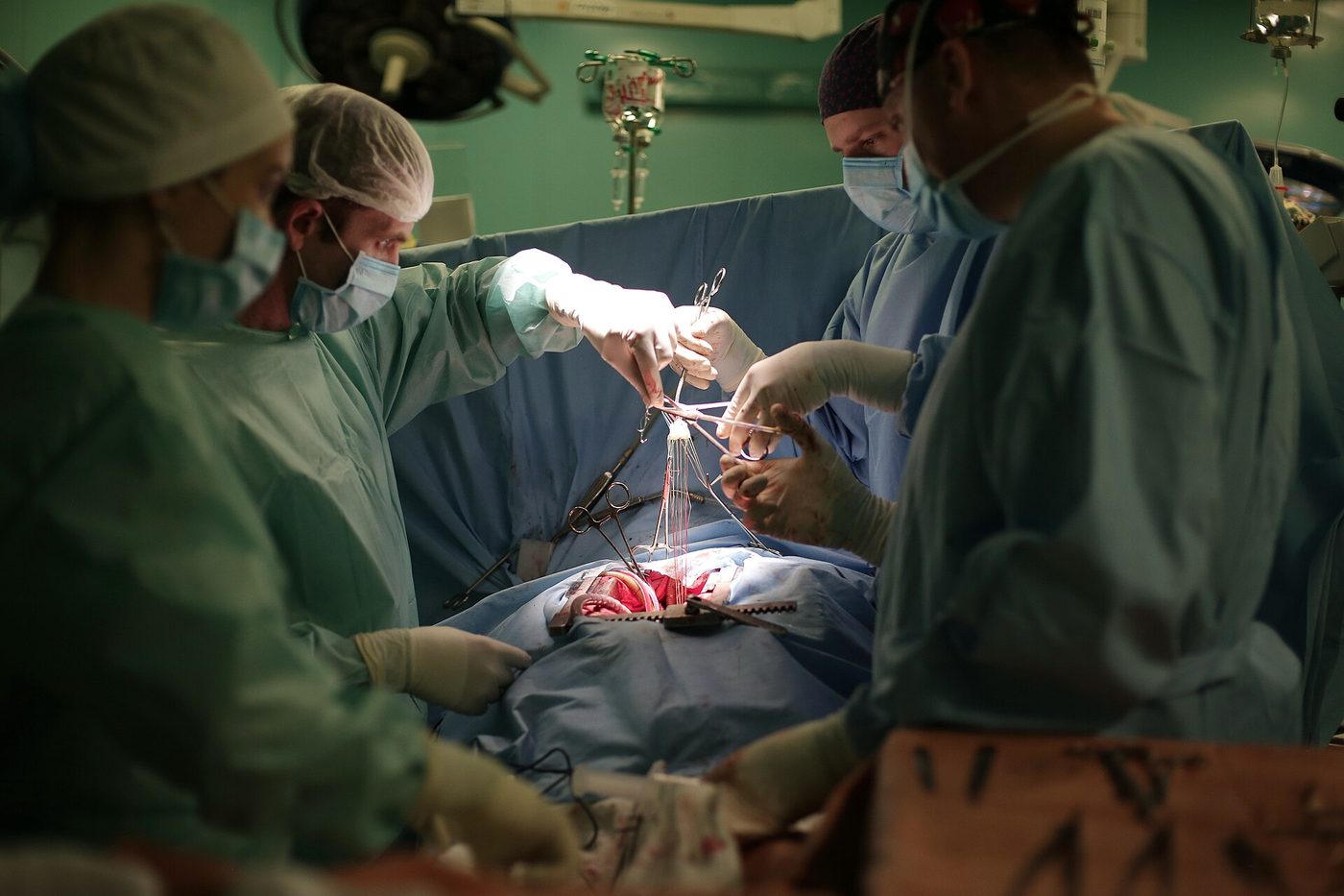 Surgeons in an operating room performing a heart valve procedure