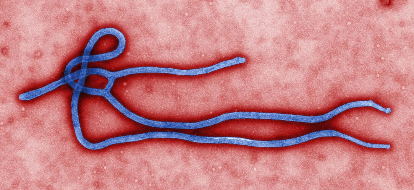 Colorized electron microscope image of a long, curled Ebola virus particle