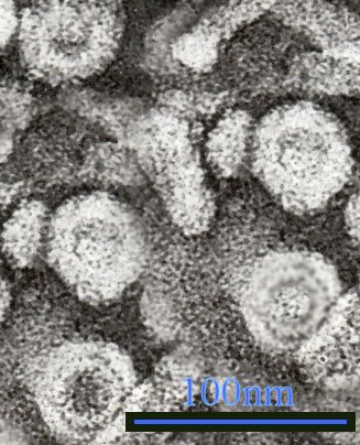 Electron micrograph of round hepatitis B virus particles