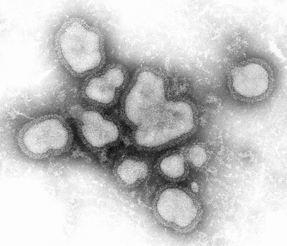 Transmission electron micrograph of influenza A virus