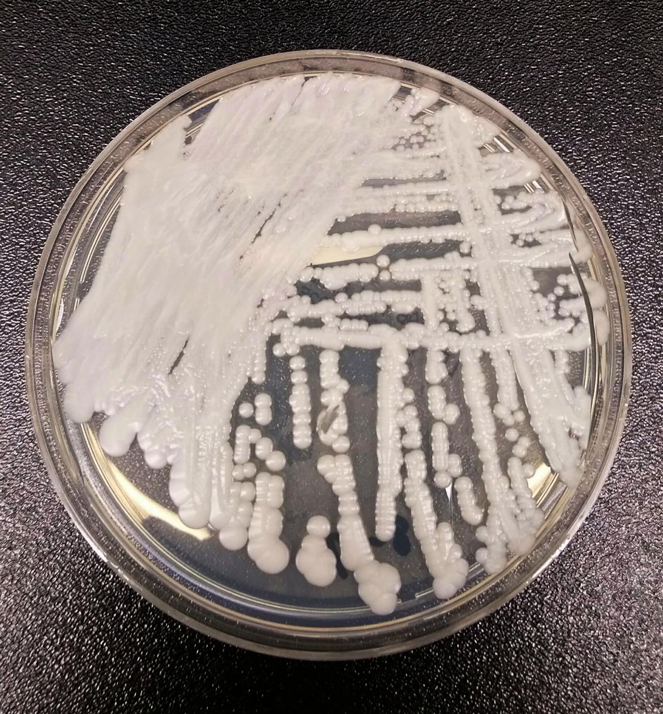 Microscope image of Candida auris