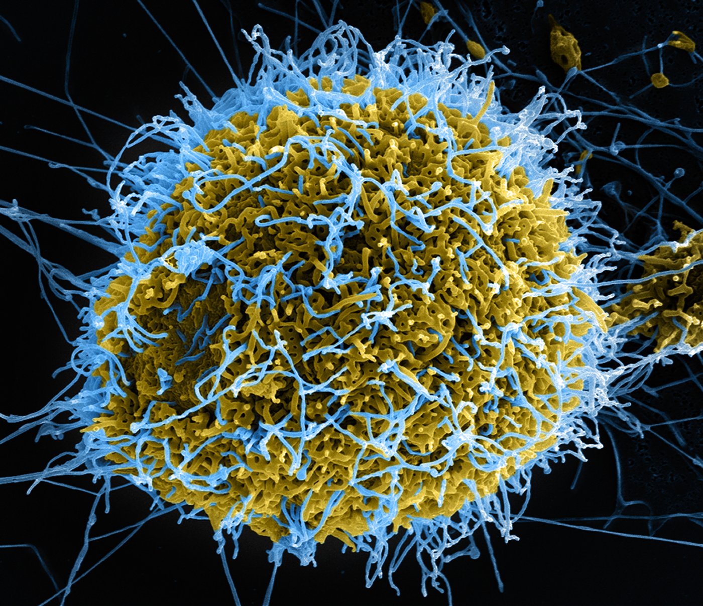 A colorized microscope image of Ebola virus particles on a cell